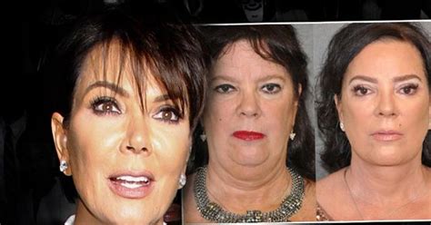 Just Like Kris Jenner S Sister Goes Under The Knife To Look Like Kuwtk Star