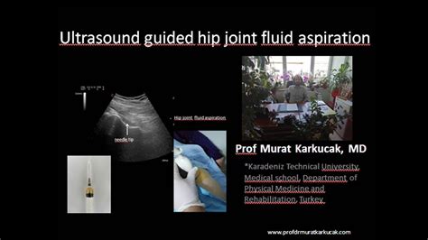 Ultrasound Guided Hip Joint Fluid Aspiration Youtube