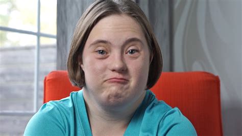 Down Syndrome Answers Who Gets Down Syndrome Youtube