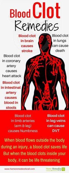 Blood Clots Remedy