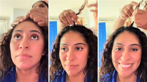 Hair Popping Pulling Hair To Relieve Headaches Poses Health Risks