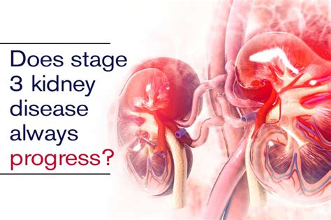 Pin On Kidney Disease Stage 3