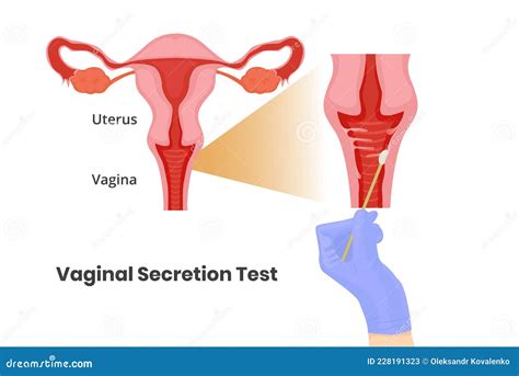 Test De S Cr Tion Vaginale Illustration Vaginale De Vectoriel De Vagin