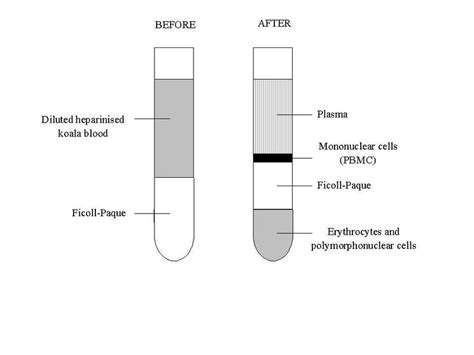 1 Separation Of Peripheral Blood Mononuclear Cells By Ficoll Paque