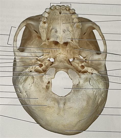 Axial Skeleton Inferior Skull Diagram Quizlet