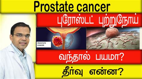 புரோஸ்டேட் புற்றுநோய் வந்தால் பயமா தீர்வு என்ன Prostate Cancer Symptoms And Treatment Youtube