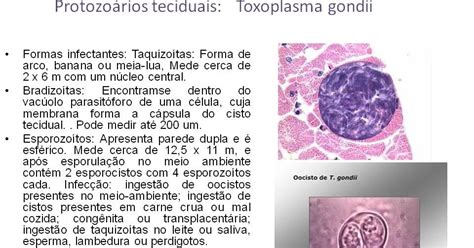 Atlas de Parasitologia e Micologia Protozoários teciduais Toxoplasma