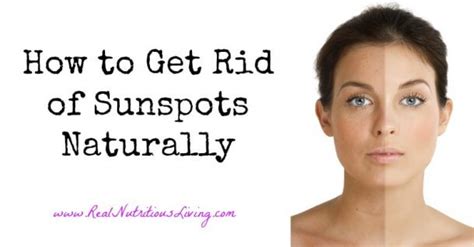How To Get Rid Of Sunspots Naturally Real Nutritious Living