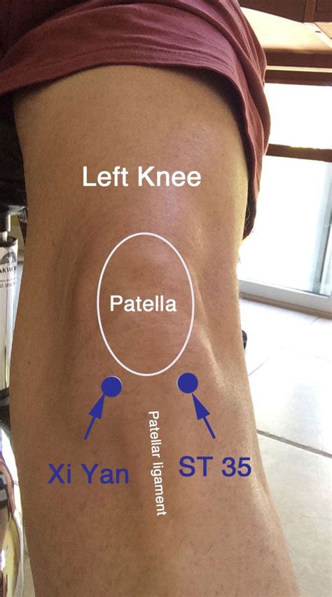 Acupuncture Points For Knee Pain And Swelling