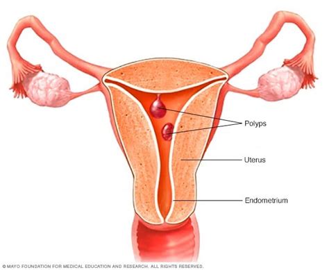 Menorrhagia Heavy Menstrual Bleeding Symptoms And Causes Mayo Clinic