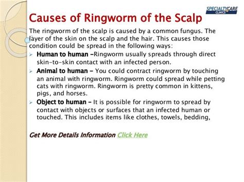 Ringworm Of The Scalp Symptoms Causes And Treatmentpptx