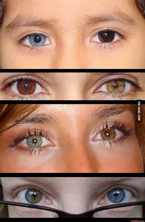 So I Heard You Like Heterochromia Funny Different Colored Eyes