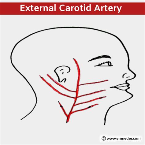 Carotid Artery Tcml The Charsi Of Medical Literature