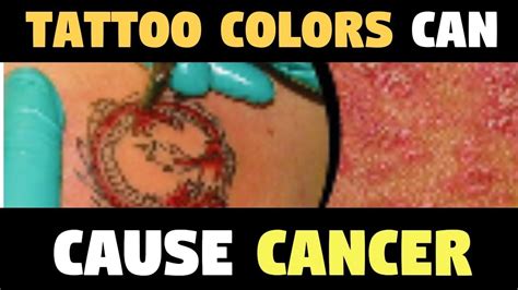 Lung cancer patients tend to report the most sleep problems. Tattoo Colors Can Cause Cancer By Scientists - YouTube
