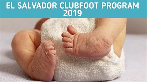 Approximately 50% of cases of clubfoot affect both feet. El Salvador Clubfoot Treatment Program - 2019 Update - YouTube