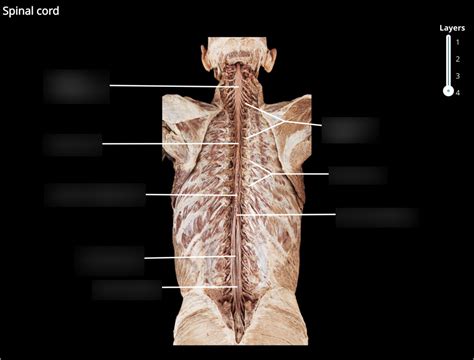 Nervous System Pal Cadaver Diagram Quizlet