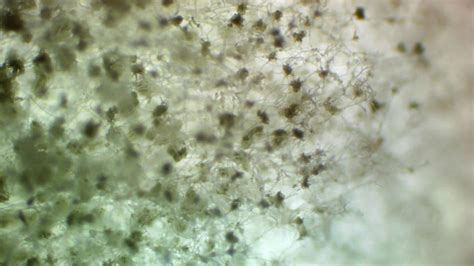 Mold Under Microscope Watch Now Youtube