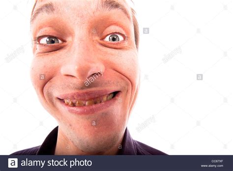 Free Download Detail Of Ugly Man Face Isolated On White Background