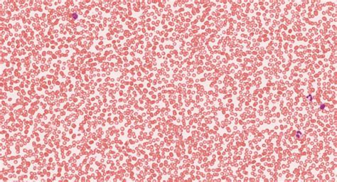 Клетки Крови Под Микроскопом Фото С Описанием Telegraph