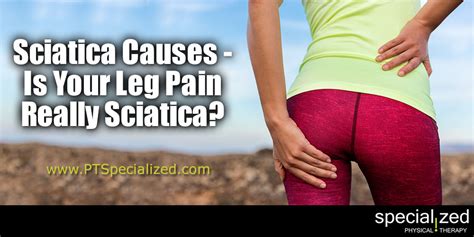 Sciatica Causes Is Your Leg Pain Really Sciatica Specialized