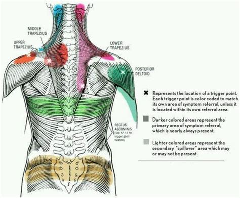 Trigger Points For Relieving Neck Back And Shoulder Pain And Stiffness