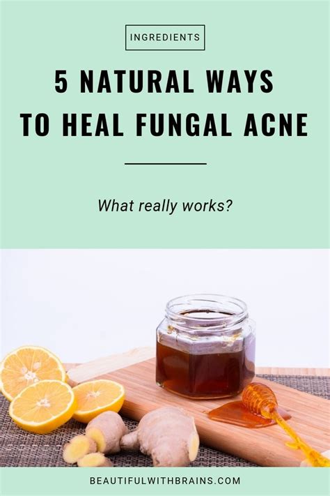 5 Natural Ways To Heal Fungal Acne That Really Work