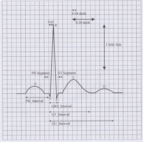 A complete guide to systematic ecg interpretation; Cara Mudah Membaca Gelombang EKG - Jantung Area