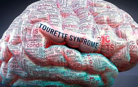 S Ndrome De Tourette Causas S Ntomas Y Tratamiento