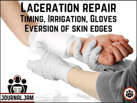 Laceration Repair Timing Gloves Irrigation And Eversion Journal Jam