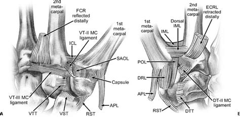 Ligament Of Treitz Ligament Of Treitz Suspensory Ligament Of