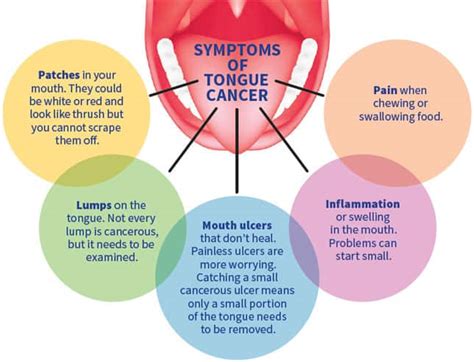 Oral Cancer Its Causes Symptoms Diagnosis And Prevention Corpus