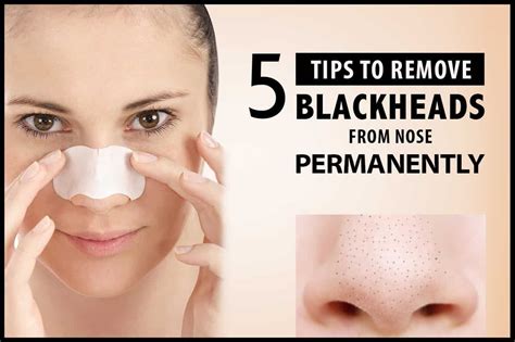 How To Permanently Remove Blackheads From Your Nose Howotre