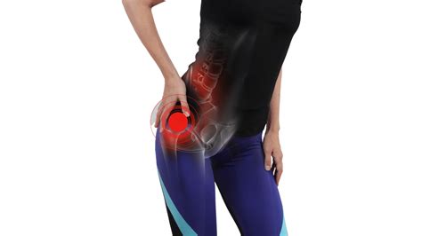 Hip Pain Bay City Health Group Osteopathy Physiotherapy And Pilates