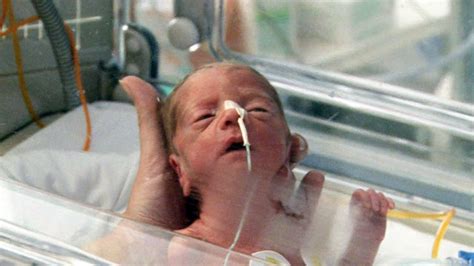 Bebés Prematuros De 6 Meses Imagui