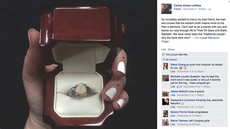 Man Proposes With Wisdom Tooth Engagement Ring