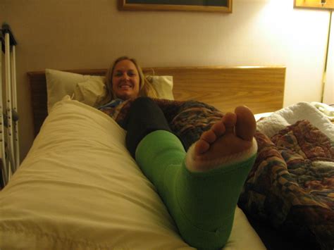 Broken Ankle Kristi Henes