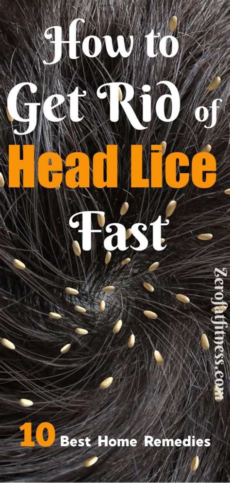 How To Get Rid Of Lice Fast 10 Best Home Remedies Effective Ways To