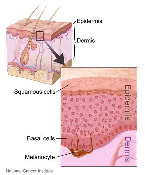 What Are The Beginning Signs Of Skin Cancer Sero