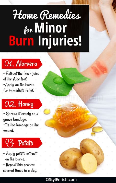 Home Remedies For Burns And To Get Relief From Pain