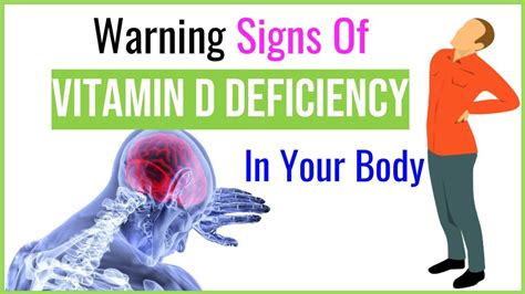 7 Signs Show That Youve Deficient In Vitamin D Vitamin D Symptoms