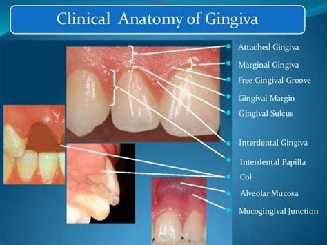 Gingival Anatomy Dental Help Dental Assistant Study Dental Anatomy