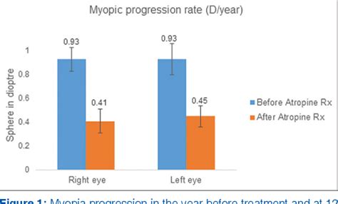 Figure 1 From Efficacy Of Low Dose Atropine To Reduce Myopia