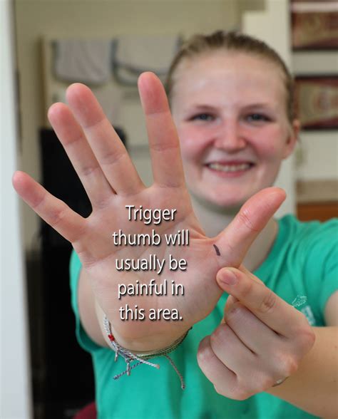 Trigger Finger or Trigger Thumb: Otherwise Known as Stenosing