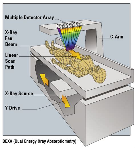What Is A Dexa Scan And How To Get It Siim Land Blog