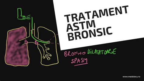 Tratament In Criza De Astm Bronsic Ilustratie Youtube