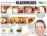 Blackhead Home Remedies Baking Soda Pictures