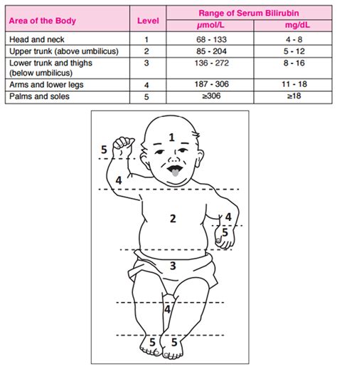 Kramer Jaundice Scale