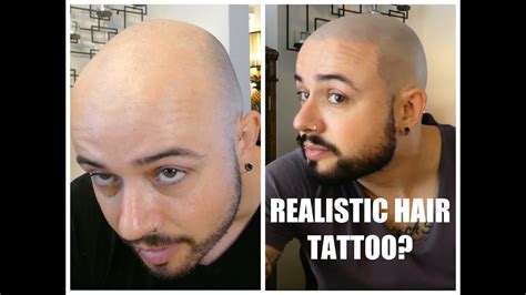 Smp Scalp Micropigmentation Hair Tattoo My Experience Youtube