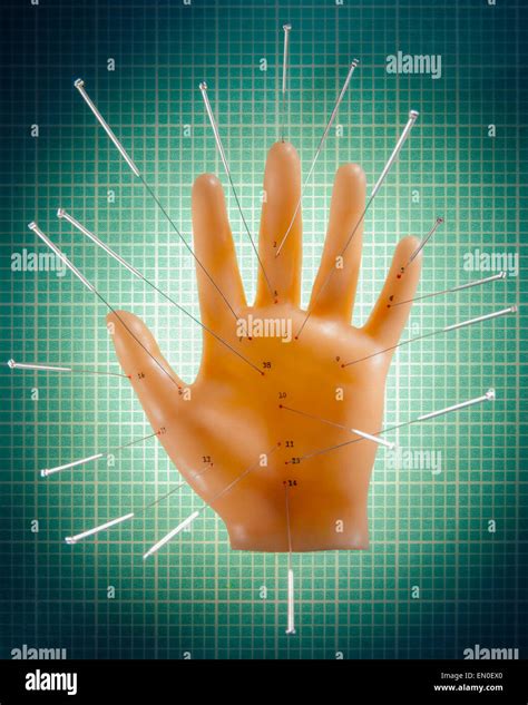 Acupuncture Pins Hi Res Stock Photography And Images Alamy