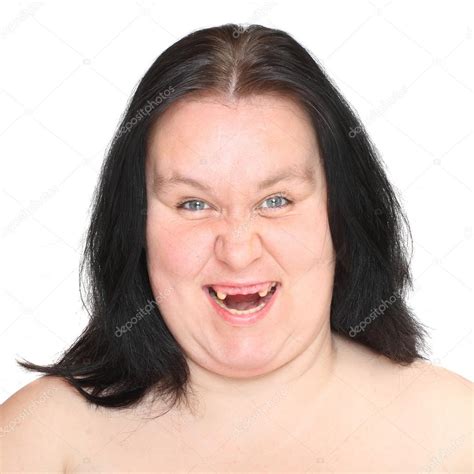 Ugly Woman With Missing Teeth Stock Photo By Vladvitek